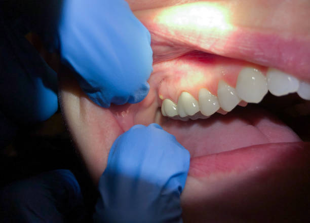 Best Cosmetic Emergency Dentistry in Capron, IL