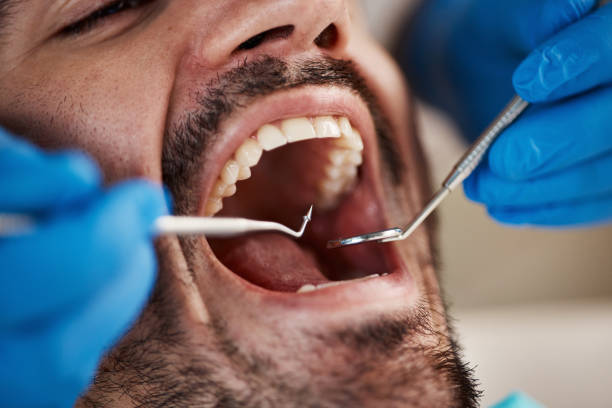 Best Emergency TMJ Treatment in Capron, IL